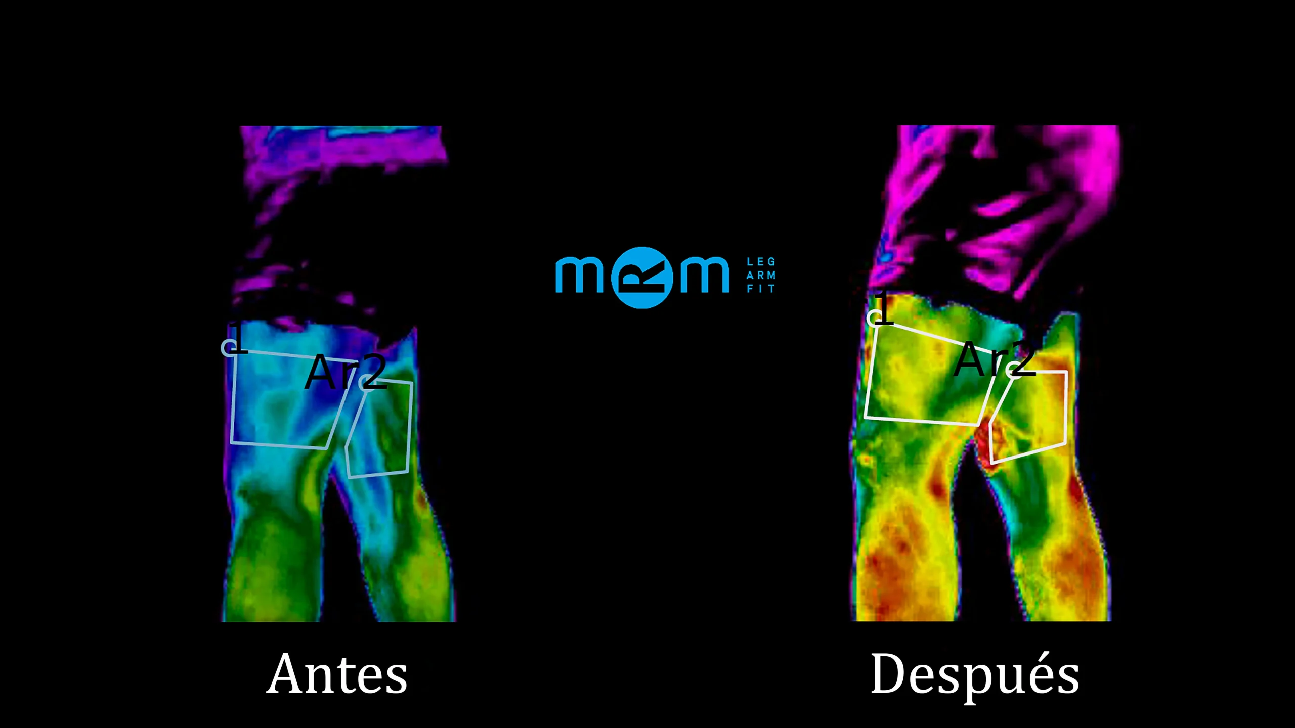 Imagen térmica comparativa de la pierna antes y después de la terapia, mostrando un aumento significativo del flujo sanguíneo con mayor temperatura y mejor circulación.