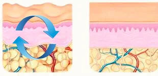Ilustración comparativa del tejido cutáneo antes y después de un masaje profundo que mejora la circulación y la apariencia de la piel.