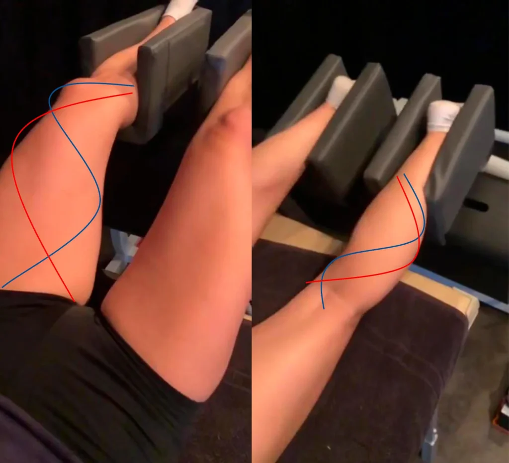 Legs placed in the MRM device performing a kinetic wave motion that combines massage and simulation of physical exertion.