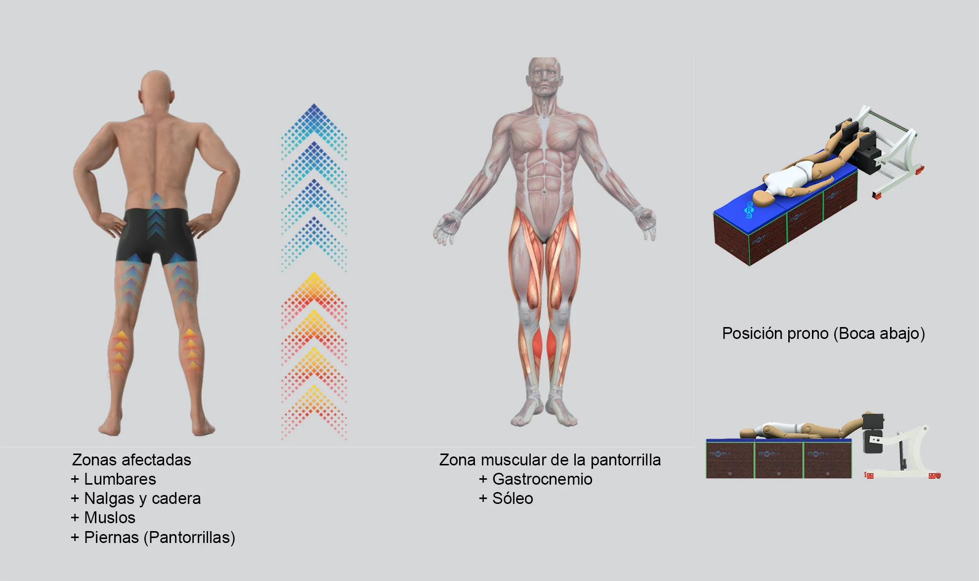 Tratamiento MRM en posición prono para zona lumbar, glúteos y pantorrillas Infografía del equipo MRM de recuperación muscular mostrando el tratamiento en posición prono (boca abajo), con indicación de las zonas tratadas: lumbares, glúteos, caderas, muslos y pantorrillas, incluyendo los músculos gastrocnemio y sóleo.