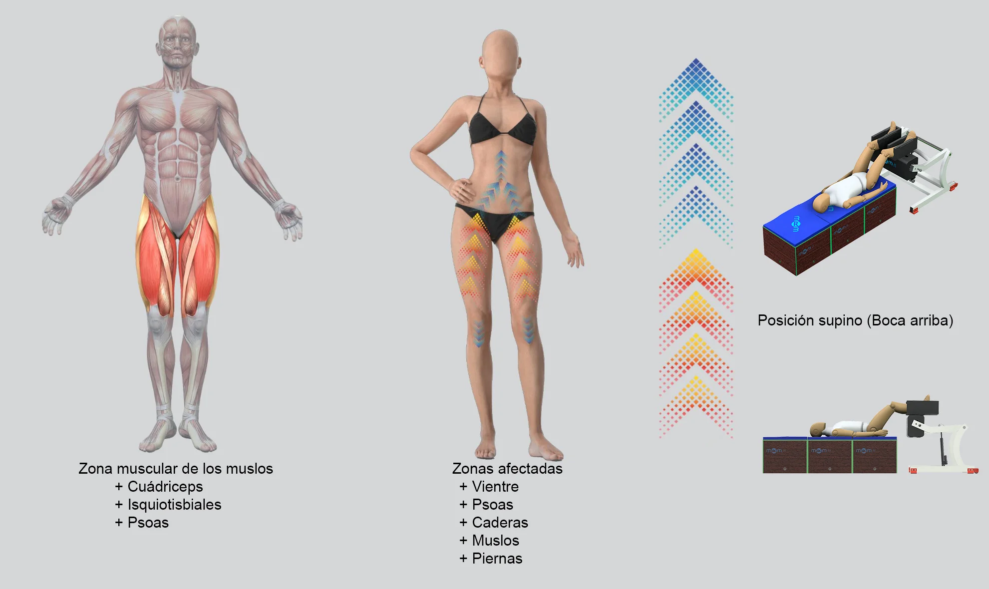 Tratamiento MRM en posición supina para musculatura de miembros inferiores y zona abdominal Infografía del equipo MRM de recuperación muscular mostrando el tratamiento en posición supina, con indicación de los grupos musculares trabajados: cuádriceps, isquiotibiales, psoas, abdomen, caderas, muslos y piernas.